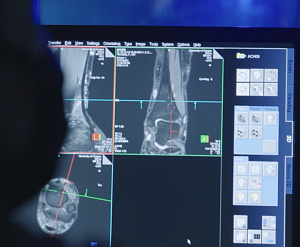 Computer screen with digital imaging photos of human foot